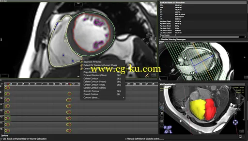 Circle Cardiovascular Imaging CVI42 v5.1.1 x64的图片1