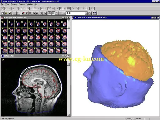 Able Software 3D-DOCTOR 5.20140721的图片1