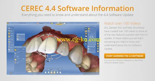 CEREC 4.4 Training Video (2015)的图片1