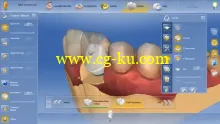 CEREC 4.4 Training Video (2015)的图片4