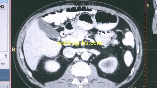 3组脑细胞快速生长科学家研究医疗器械实拍视频素材的图片1